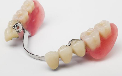 Kancalı Diş Protezi Nedir?