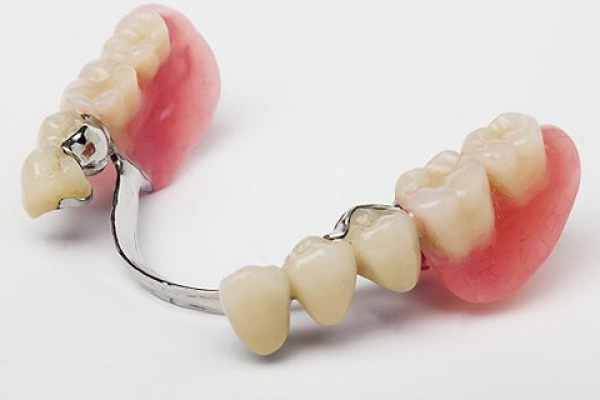 Kancalı Diş Protezi Nedir?