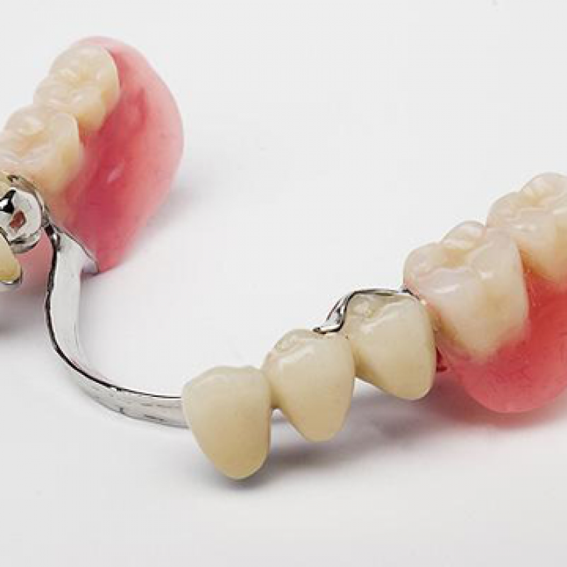 Kancalı Diş Protezi Nedir?