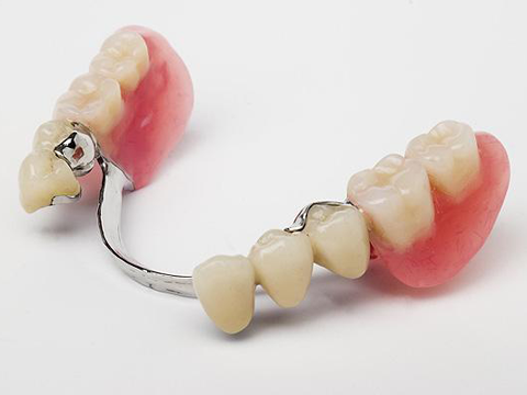 What is Dental Hook Prosthesis?