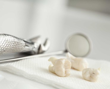 Reshaping After Tooth Loss with Dental Bone Grafting