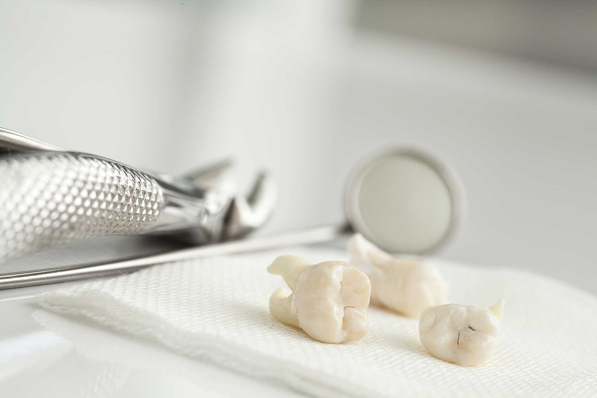 Reshaping After Tooth Loss with Dental Bone Grafting