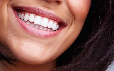 Gülüş Tasarımında Kişiye Özel Estetik Çözümler Nasıl Geliştirilir?