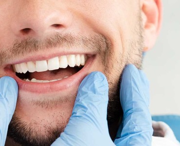 Smile Aesthetics: Ways to Achieve White Teeth
