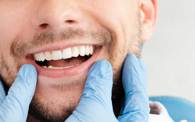 Gülüş Estetiği: Beyaz Dişlere Ulaşmanın Yolları