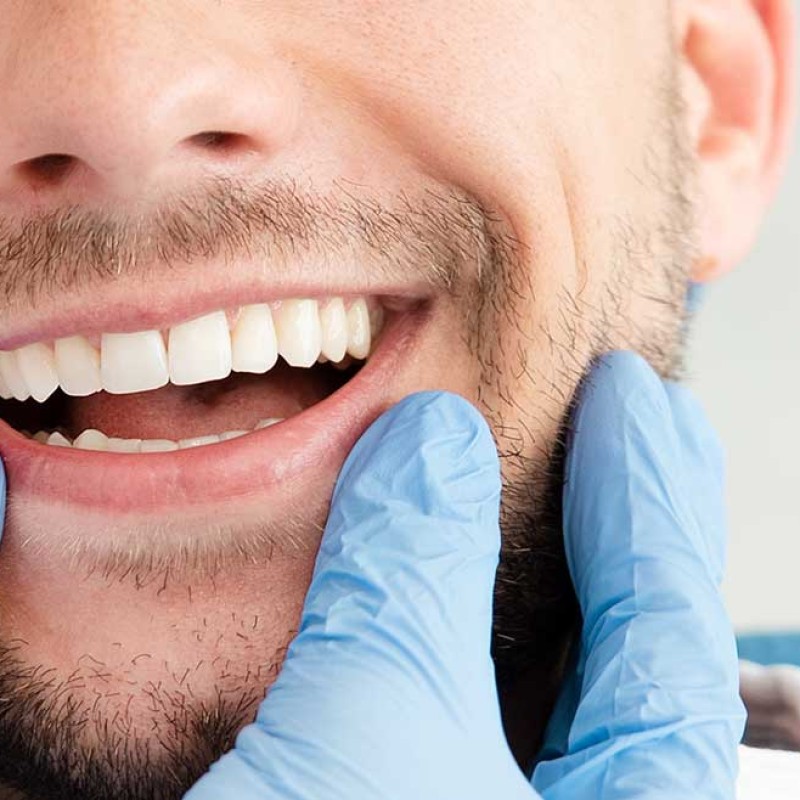 Smile Aesthetics: Ways to Achieve White Teeth