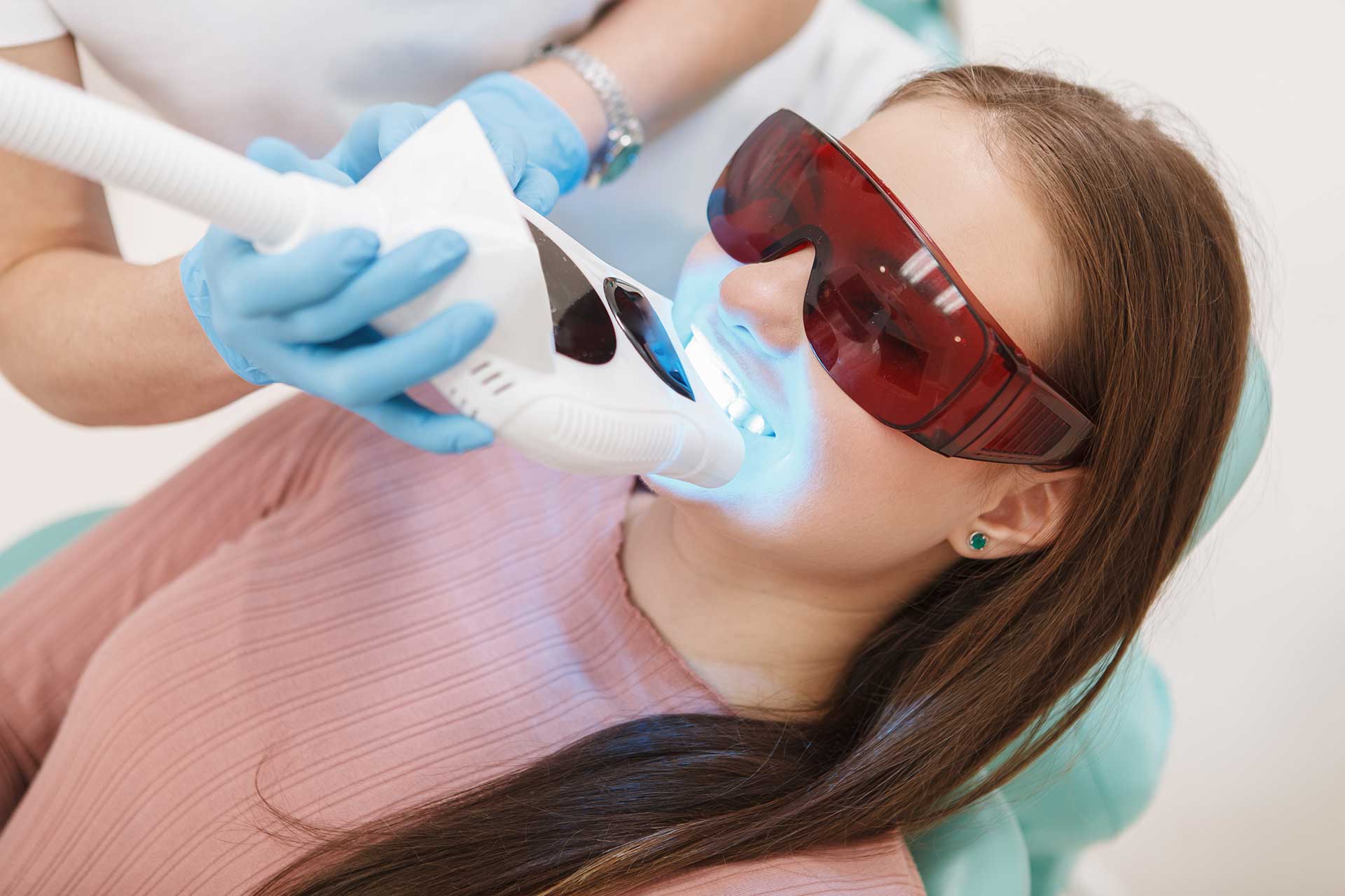 Which Teeth Whitening Method is More Suitable for You?