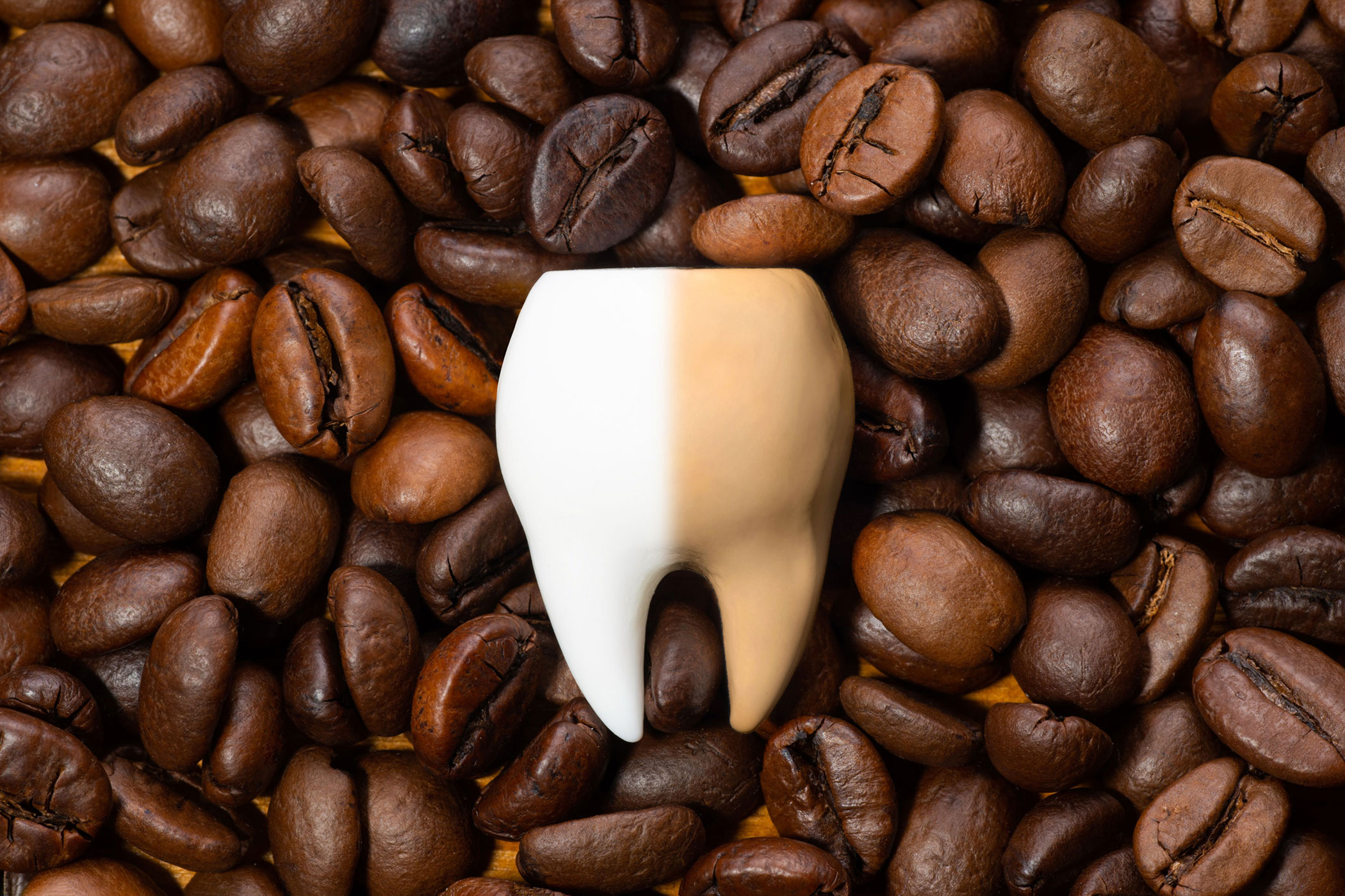 Which Foods Cause Tooth Stain?