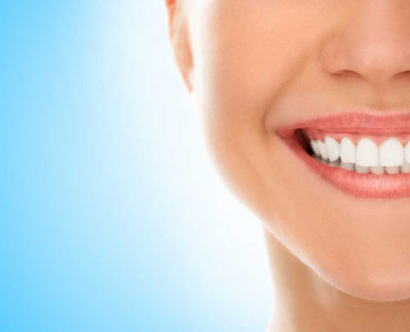 What Is Hollywood Smile? How To Get A Hollywood Smile? 