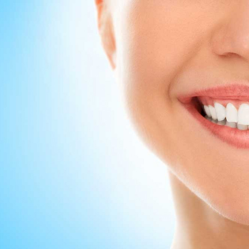 What Is Hollywood Smile? How To Get A Hollywood Smile? 
