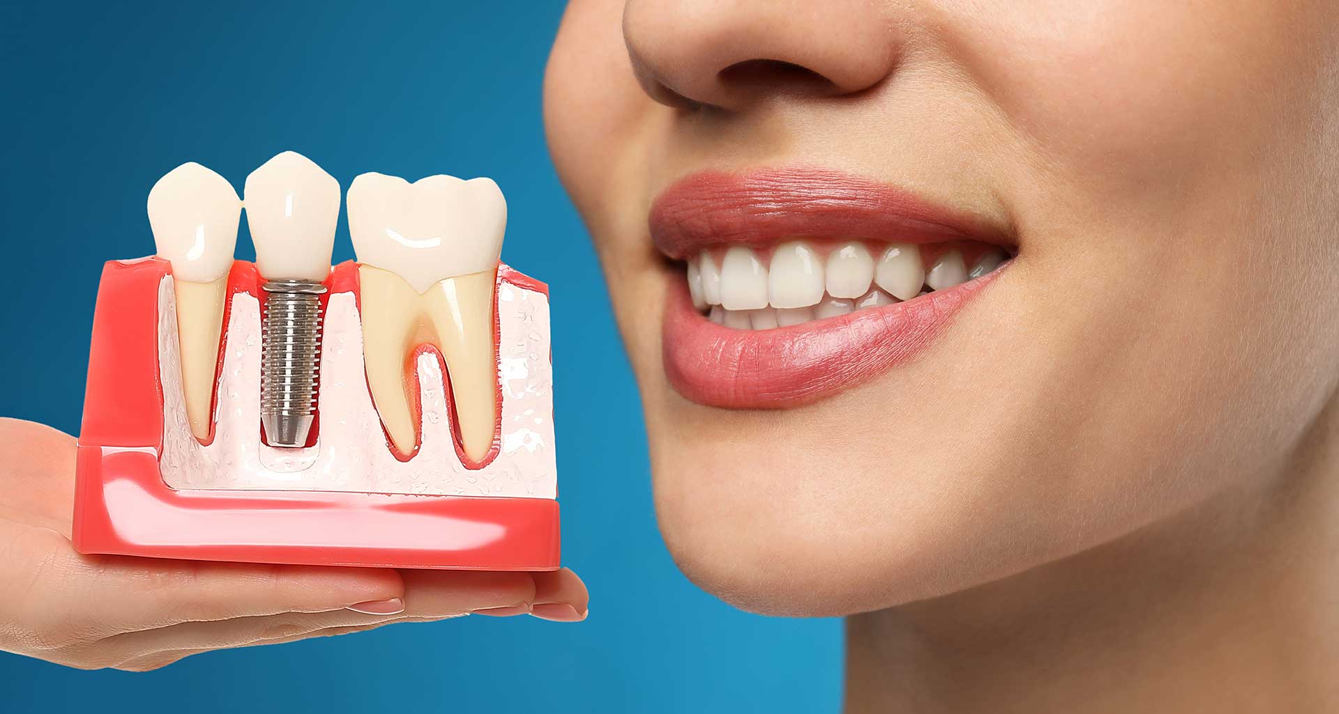 Advantages and Disadvantages of Dental Implant