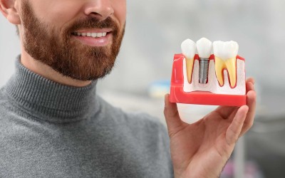 İmplant Tedavisi Öncesinde Bilmeniz Gerekenler