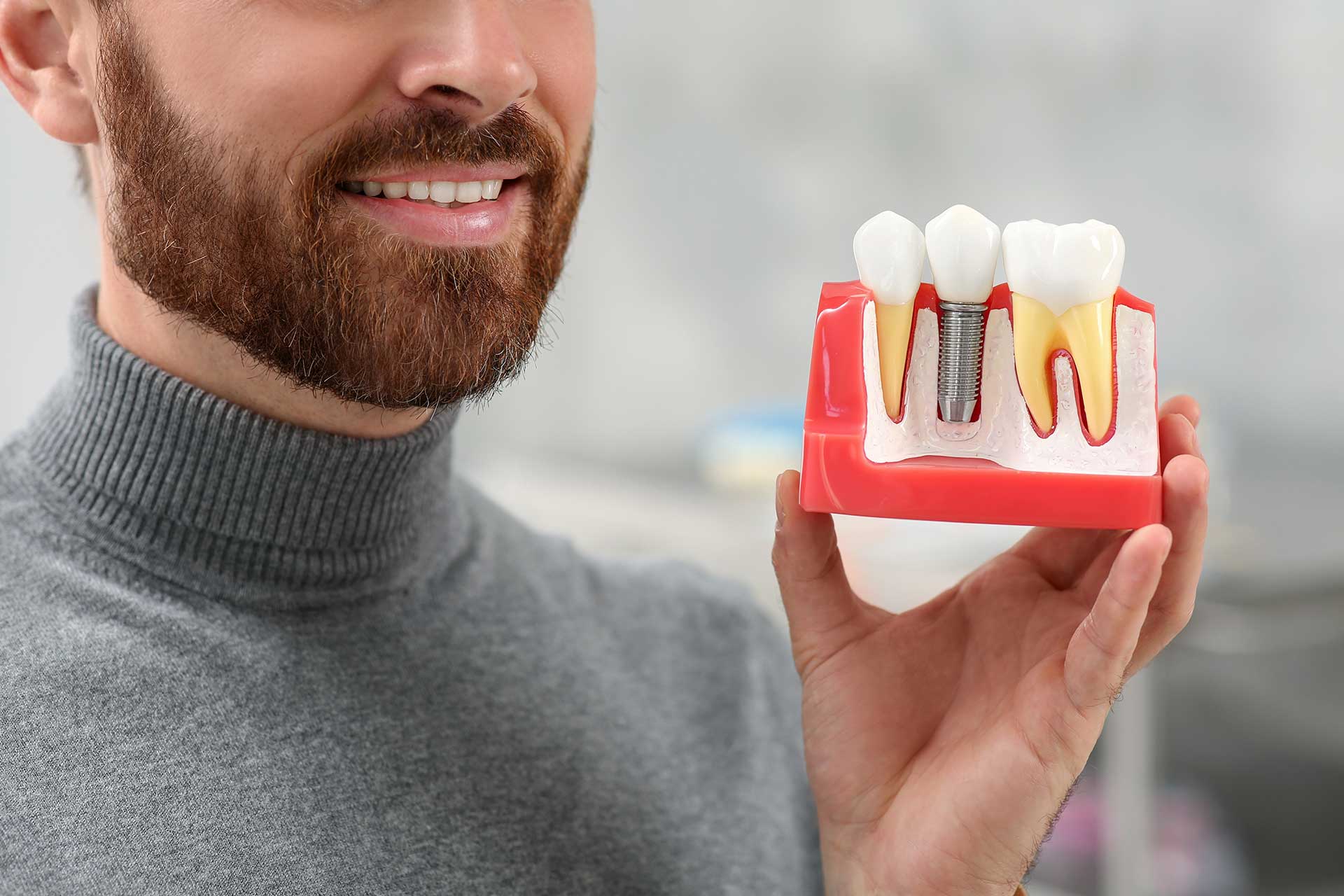 What You Need to Know Before Dental Implant Treatment