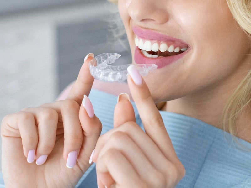 Invisalign-Behandlung