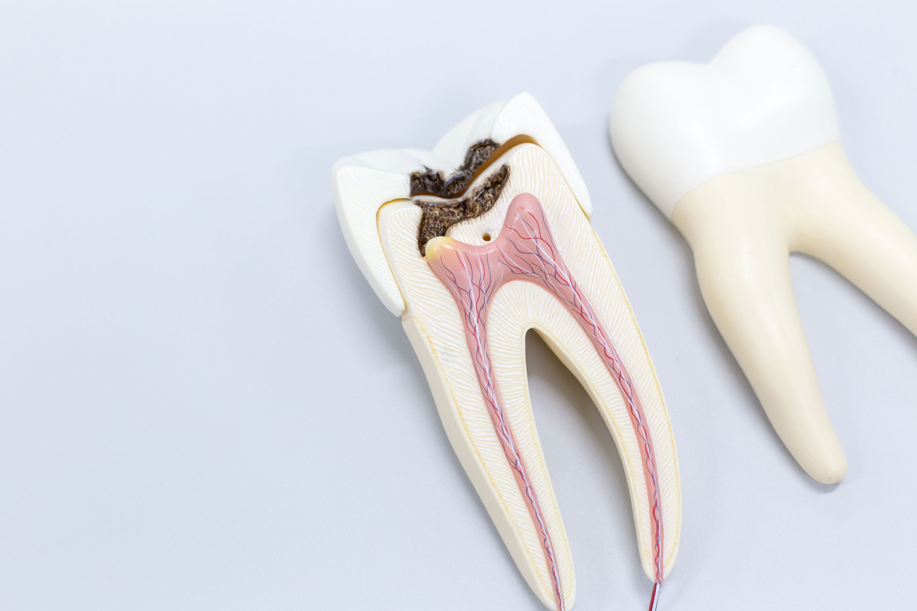 False Facts About Root Canal Treatment