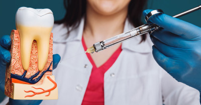 Root Canal Treatments