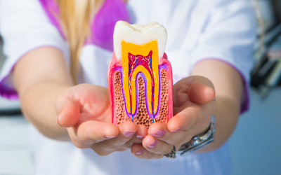 Kanal Tedavisi ile İlgili Sık Sorulanlar