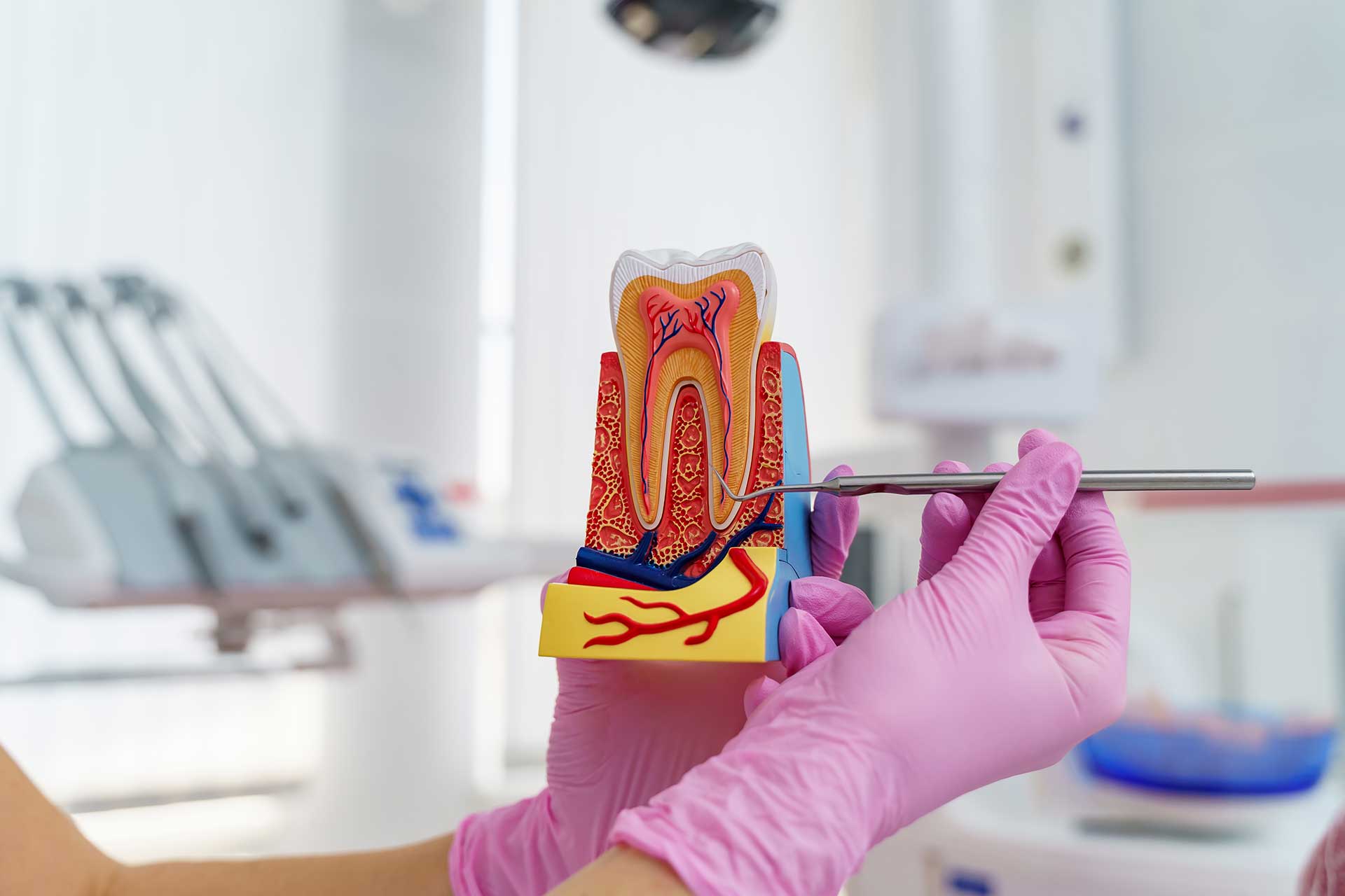 Step-by-Step Guide for Root Canal Treatment Process