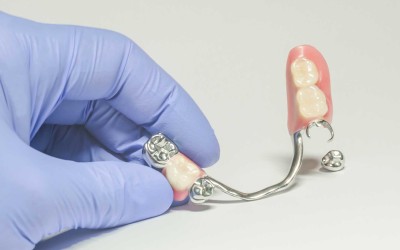 Kısmi Protezler Ne Zaman Tercih Edilmeli?