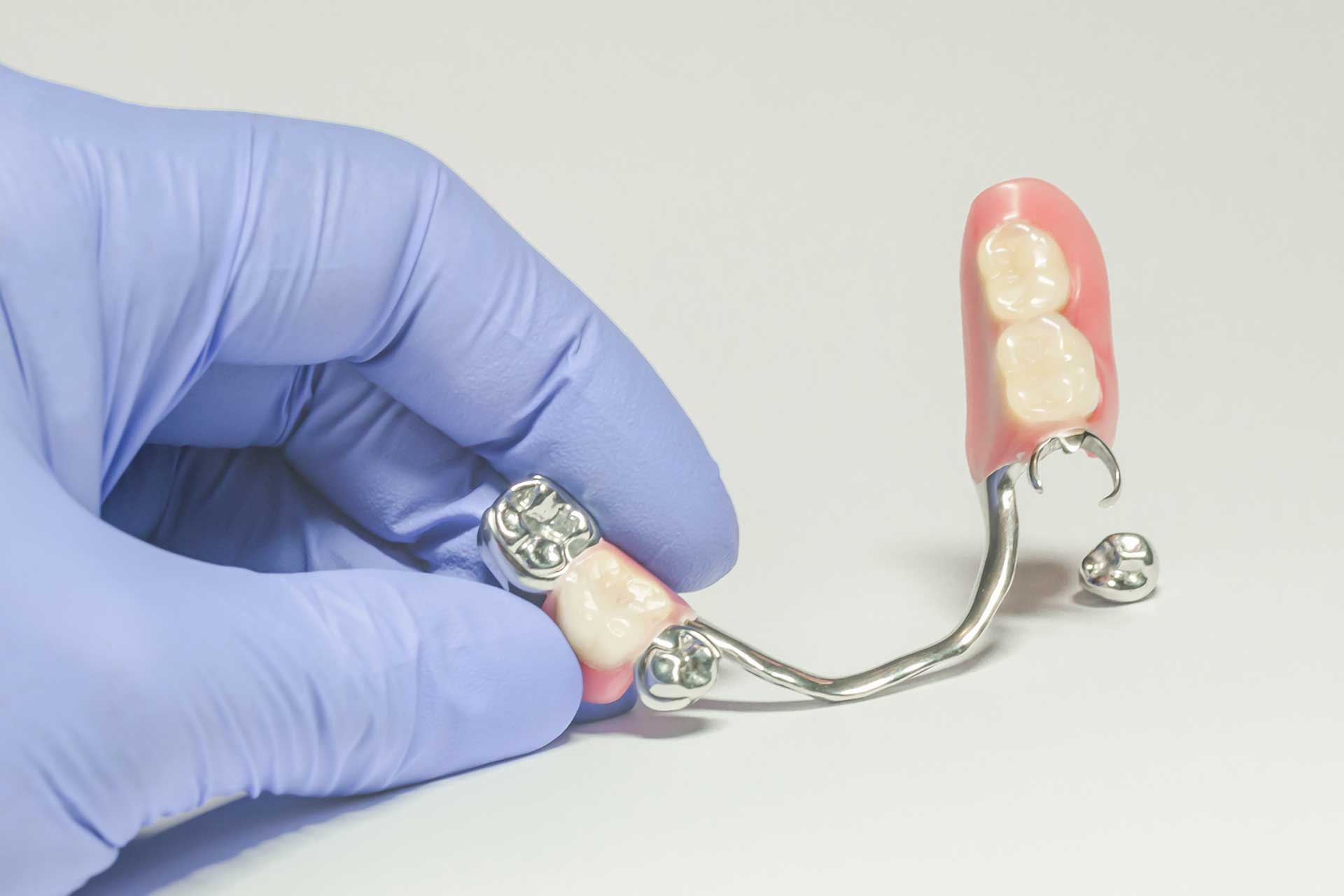 When Should Partial Dentures Be Preferred?