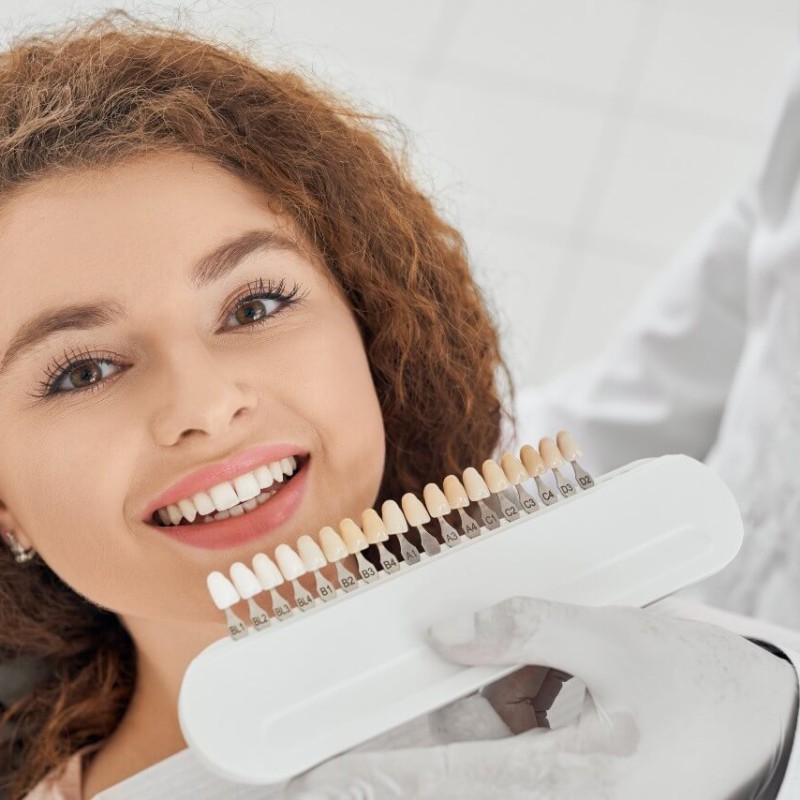 Ways to Conceal Dental Imperfections with Laminate Veneers