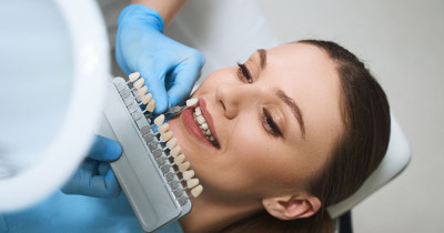 Laminated Dental Veneer 