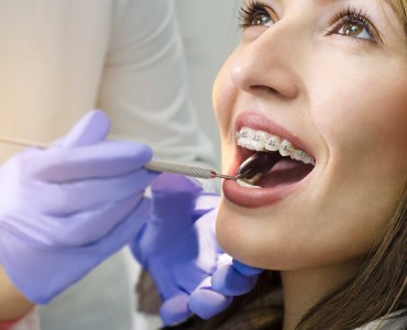 Orthodontic Treatment: What You Need to Know