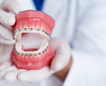 Why is Early Intervention Important in Orthodontic Problems?