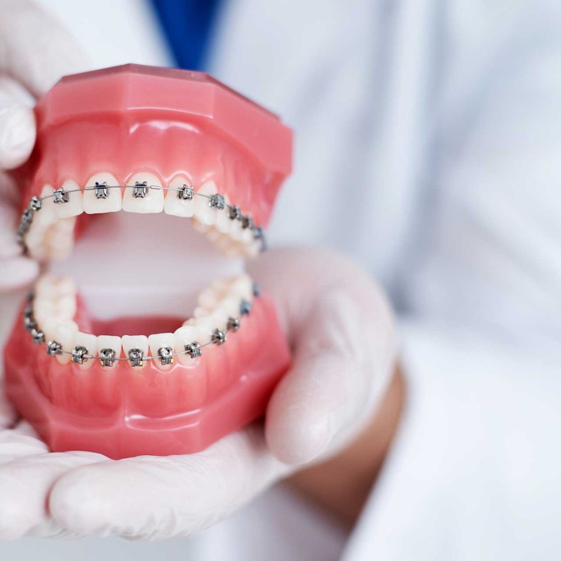 Why is Early Intervention Important in Orthodontic Problems?