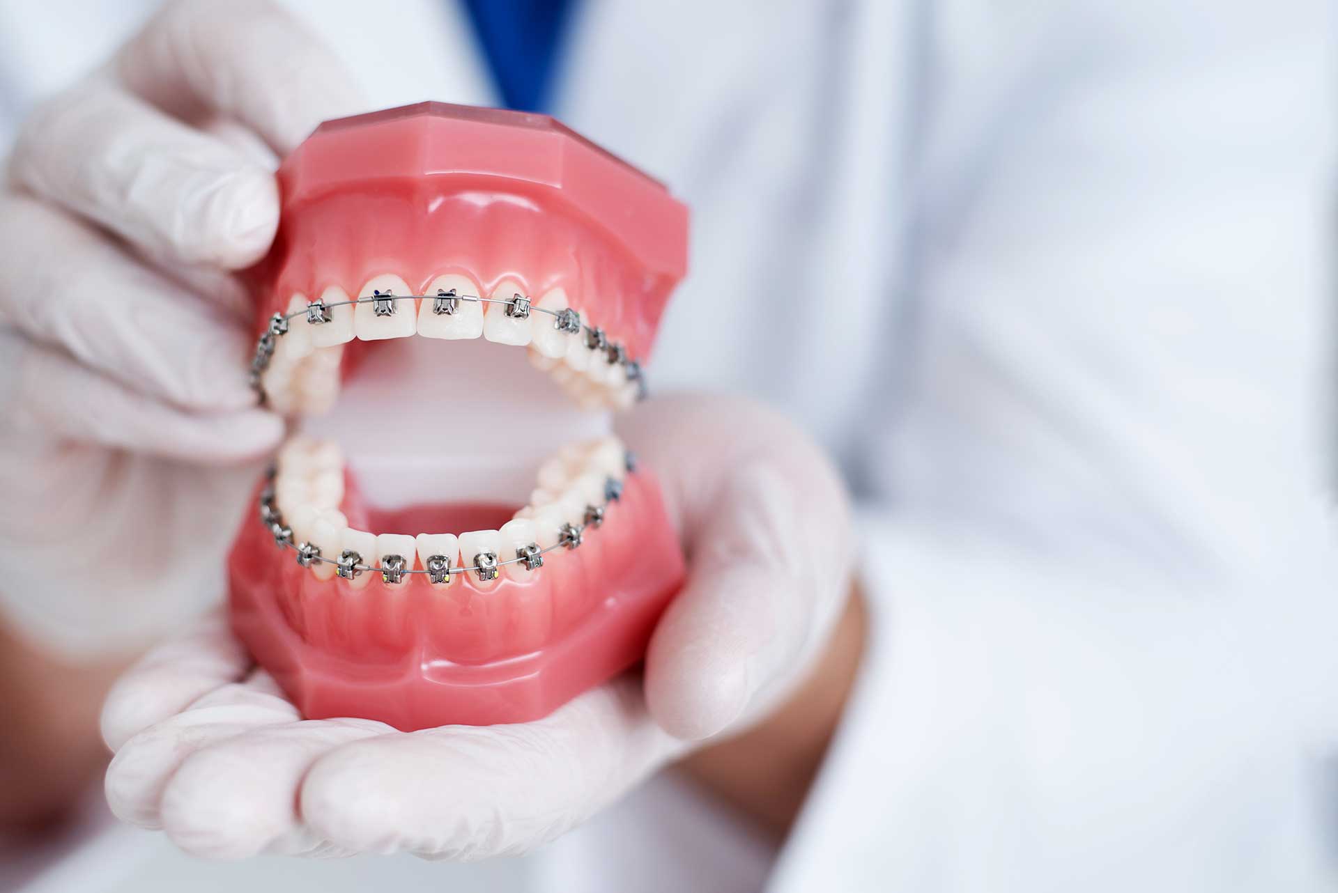 Why is Early Intervention Important in Orthodontic Problems?