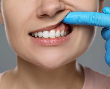 Periodontal Tedaviler: Diş Eti Hastalıklarını Yenmek için Adımlar