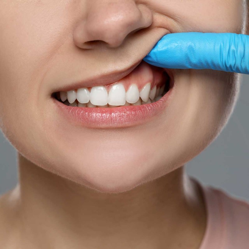 Periodontal Treatments: Steps to Overcome Gum Diseases