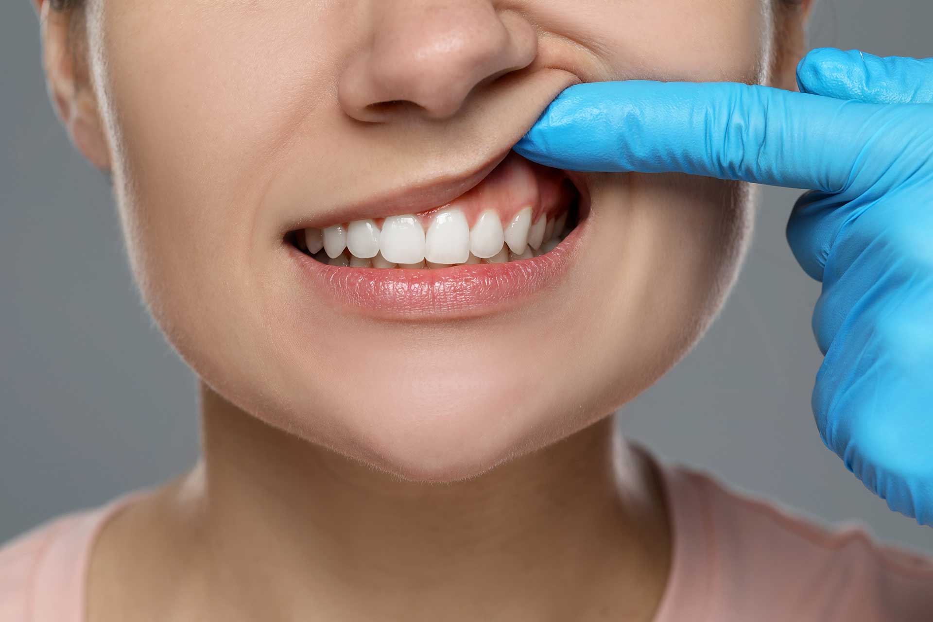 Periodontal Tedaviler: Diş Eti Hastalıklarını Yenmek için Adımlar