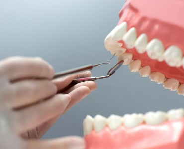 Periodontoloji ile Sağlıklı Diş Etleri Nasıl Sağlanır?