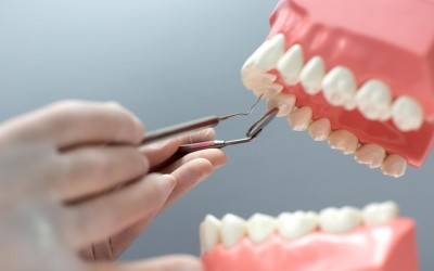 Periodontoloji ile Sağlıklı Diş Etleri Nasıl Sağlanır?