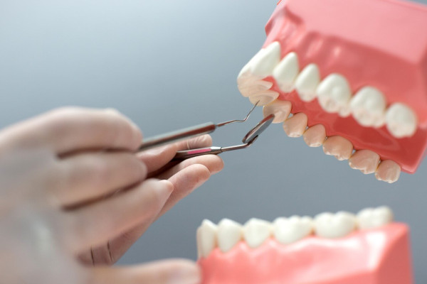 Periodontoloji ile Sağlıklı Diş Etleri Nasıl Sağlanır?