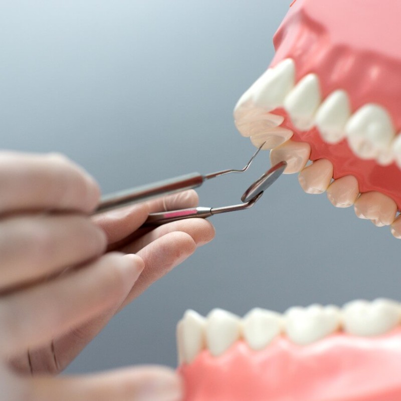 Periodontoloji ile Sağlıklı Diş Etleri Nasıl Sağlanır?