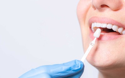 Porselen Diş Kaplama Nedir? Avantajları ve Dezavantajları