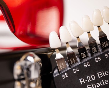 Restoratif Diş Tedavisi Nedir? Nasıl Yapılır?