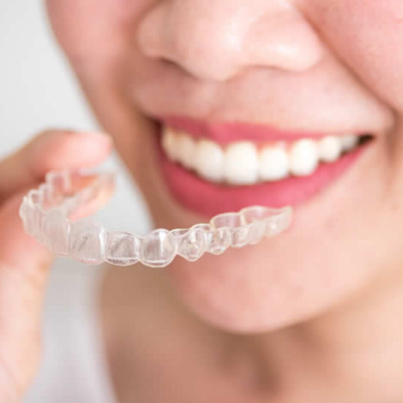 Şeffaf Plak İle İlgili Sıkça Sorulan Sorular