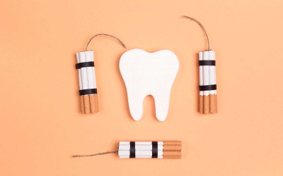 Sigara ve Diş Sağlığı Arasındaki İlişki