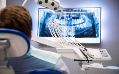 Sinüs Perforasyonu Nedir?