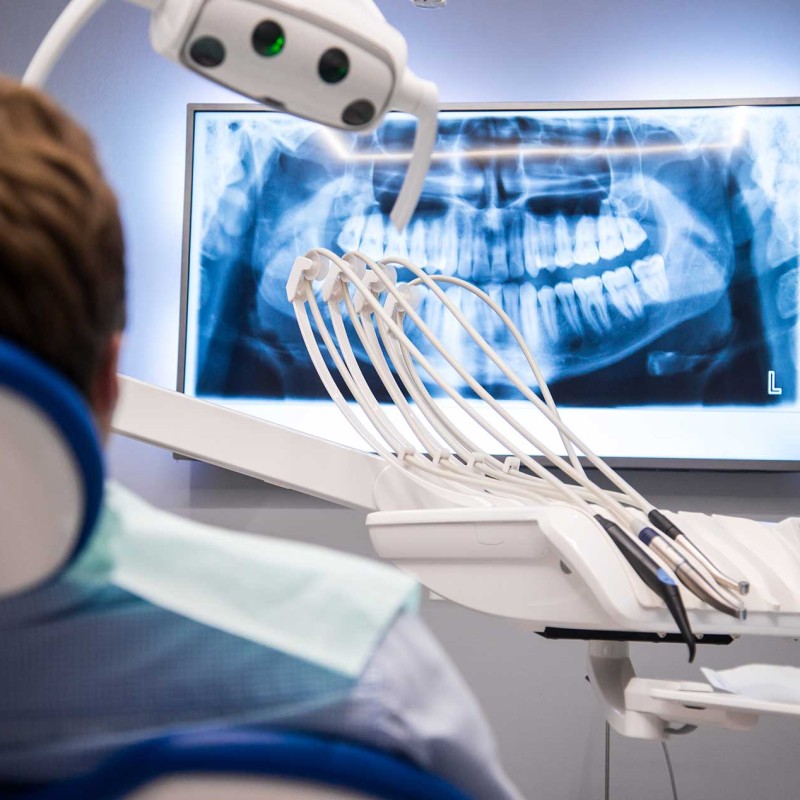 What is Sinus Perforation?