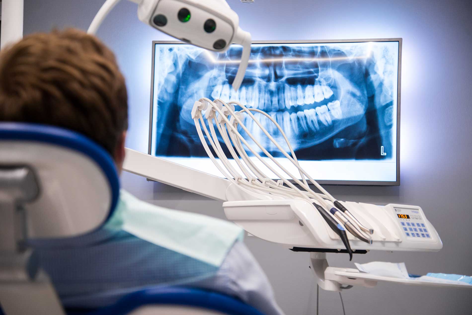 What is Sinus Perforation?