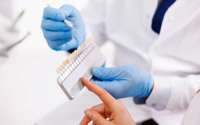 Timeless and Aesthetic Smiles with Zirconium Dental Coatings